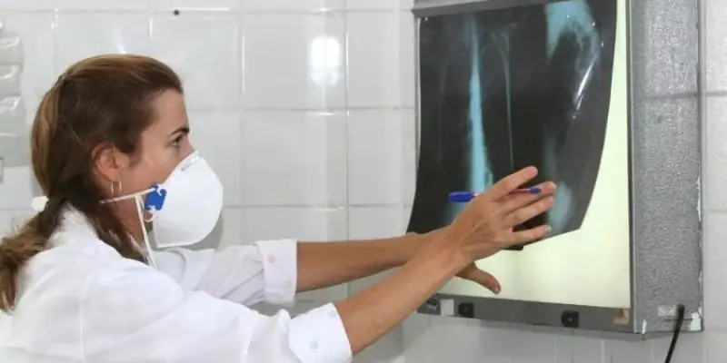 Uberlândia tem 49 casos de tuberculose